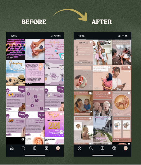 Love Your Ears Before and After